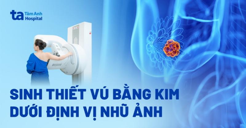 Hình ảnh minh họa việc chăm sóc vết thương nhỏ sau sinh thiết, ví dụ: một người đang thay băng cho vết thương nhỏ trên da